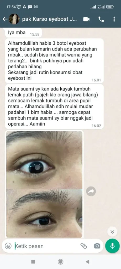 testi-katarak-1.webp