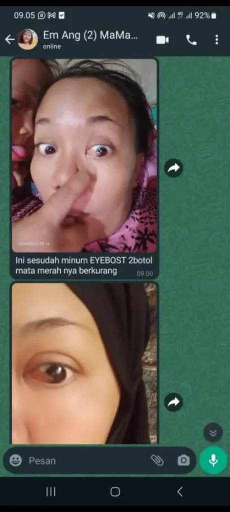 testi-lemak-mata-2-.webp